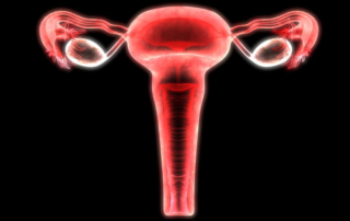 ReUnite Rx Hysterosalpingography: When A Hysterosalpingogram (HSG) is Needed For Infertility