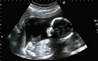 ReUnite Rx How Technology Is Changing How We Treat Infertility