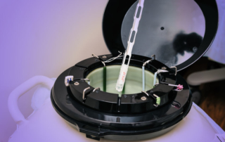 ReUnite Rx 3 Reasons To Consider Egg Freezing Age Endometriosis And Ovarian Cysts