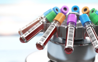 Fertility Evaluation In Women: What Blood Tests Are Done In An Infertility Workup?