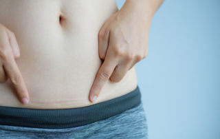 ReUnite Rx Can Fibroids Reduce Fertility Diagnosis Treatment Options