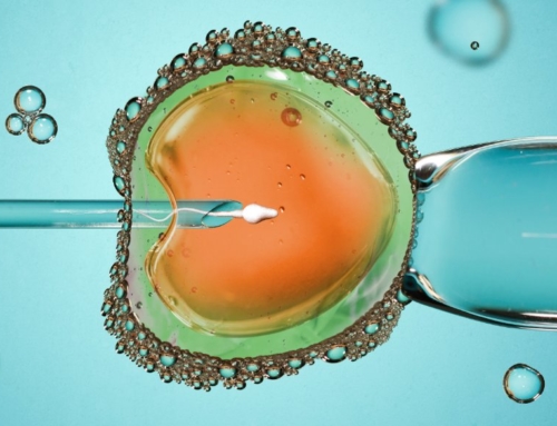 Can IVF Lead To OHSS? Causes & Treatment Options For Ovarian Hyperstimulation Syndrome