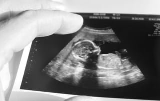 reunite rx Technology _ IVF 3 Innovative Ways Clinics Can Improve Your Chances Of Pregnancy.jpg