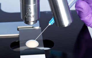 reunite-rx-Are-All-Vasectomies-Permanent-A-Second-Chance-With-Micro-Epididymal-Sperm-Aspiration