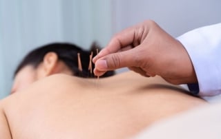 reunite-rx-Acupuncture-For-Fertility-How-Integrative-Medicine-Supports-Blood-Flow-To-The-Uterus
