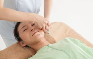 reunite-rx-How-Acupuncture-May-Support-Your-Fertility-Journey
